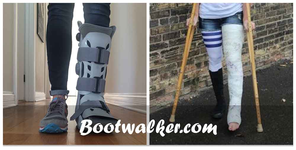 Traditional Cast vs Boot for Broken Foot. Which is better? Boot Walker