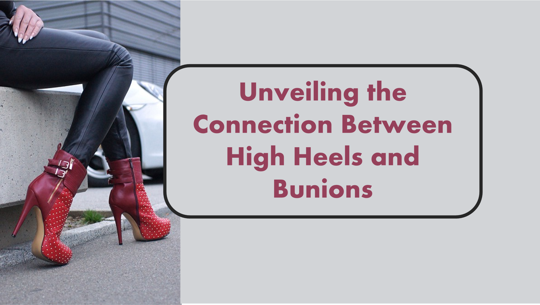 Bunion Blues: Unveiling the Connection Between High Heels and Bunions ...